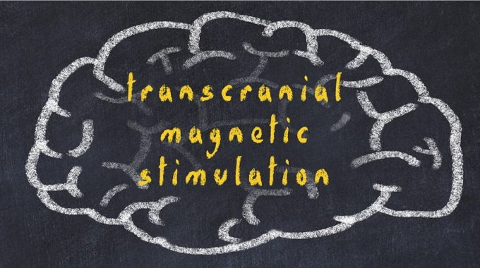 Transcranialmagneticstimulation Tms